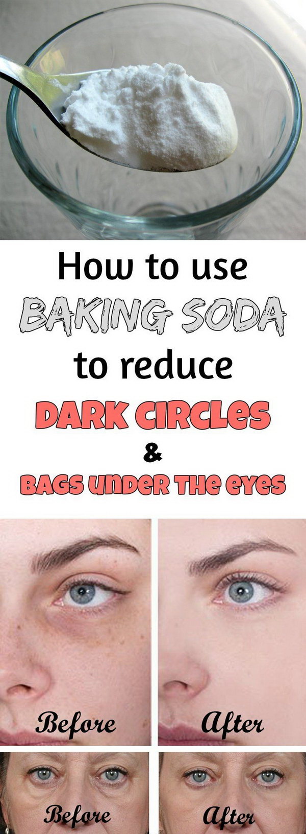 How do you get rid of under-eye circles?