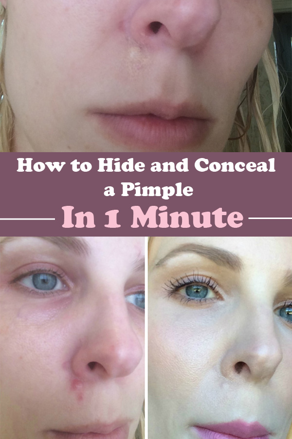 How To Hide And Conceal A Pimple In 1 Minute. 