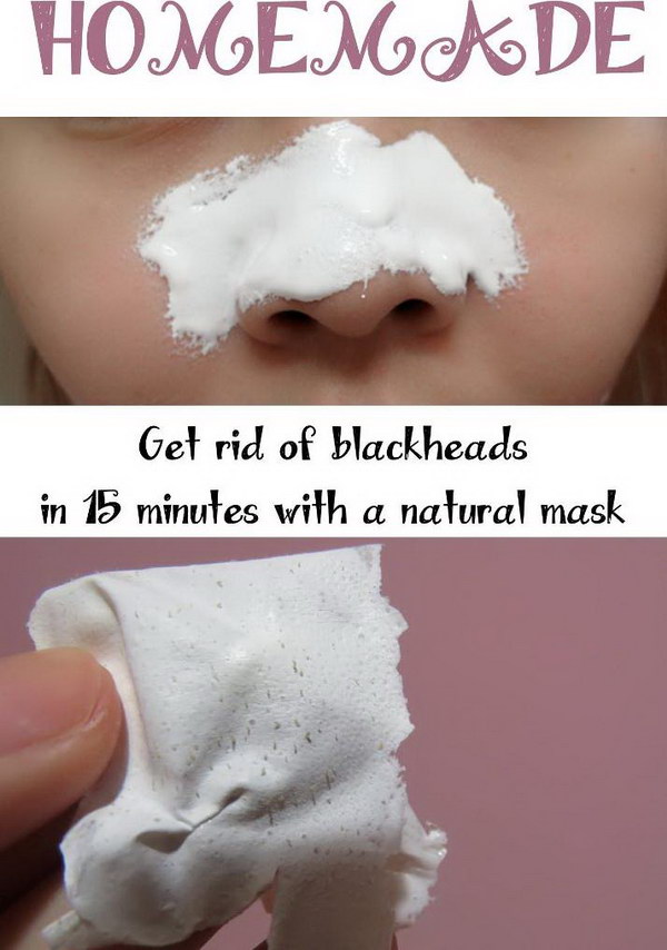 facial mask for blackheads homemade