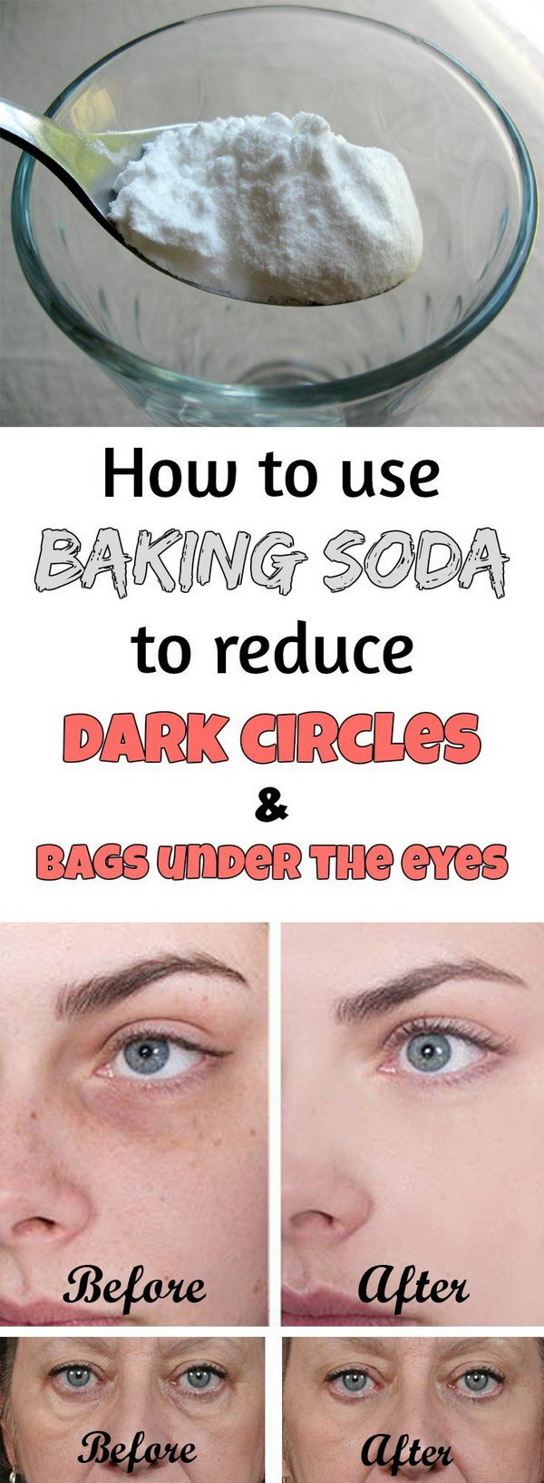 15 Ways To Get Rid Of Dark Circles Under Your Eyes 2023