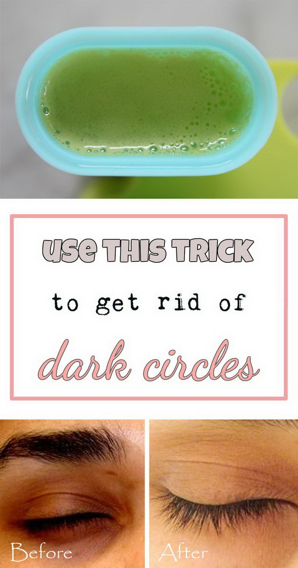 ways to get rid of dark circles under your eyes